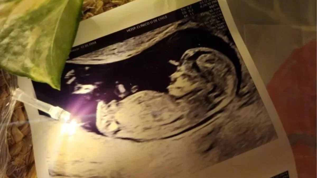 “Una periodista de farándula estaba amenazando con filtrar el embarazo. Le pedimos por favor que no lo hiciera, no le habíamos dicho a nuestras familias”