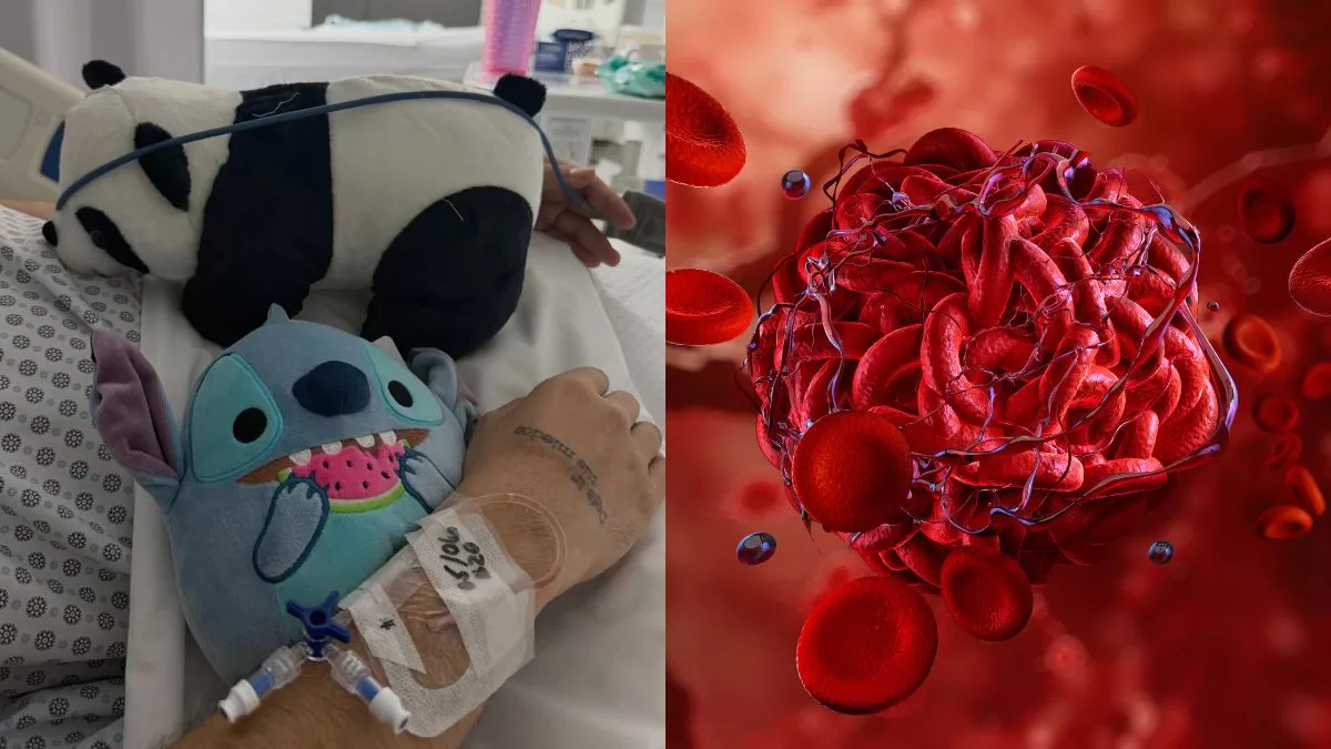 Trombosis Cómo Prevenir (1)