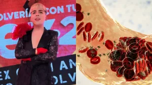 Tras grave estado de salud de Diego Pánico: doctor explica por qué ocurre la trombosis y cómo prevenirla