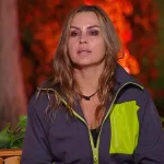 Yasmin Valdés se somete a drástico procedimiento estético: "Qué hermoso le quedará el rostro"