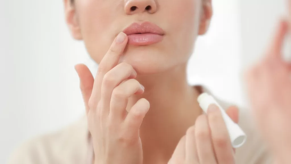Labios Resecos