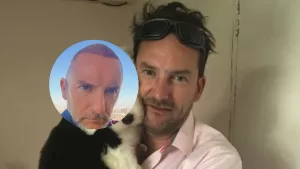Daniel Fuenzalida estrena nuevo look debido a procedimiento médico: "Un implante de..."