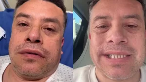 "Pensé que moriría o quedaría con algo grave": El duro relato de Leandro Martínez que preocupó a sus seguidores