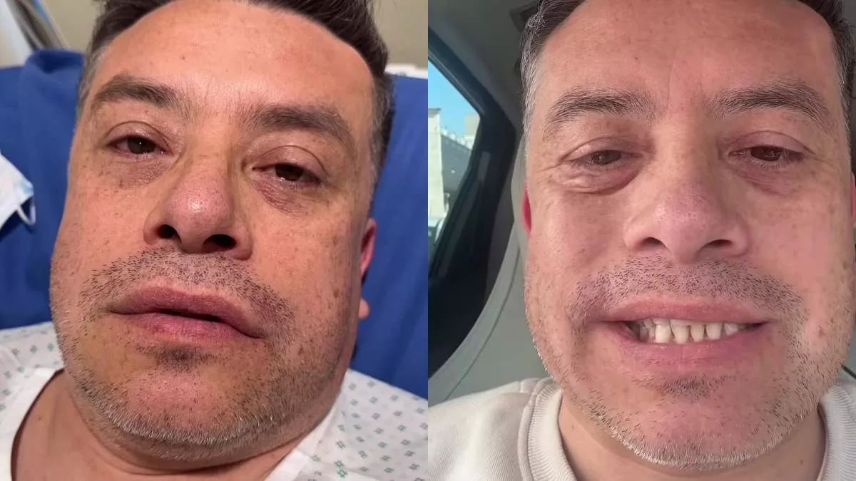"Pensé que moriría o quedaría con algo grave": El duro relato de Leandro Martínez que preocupó a sus seguidores